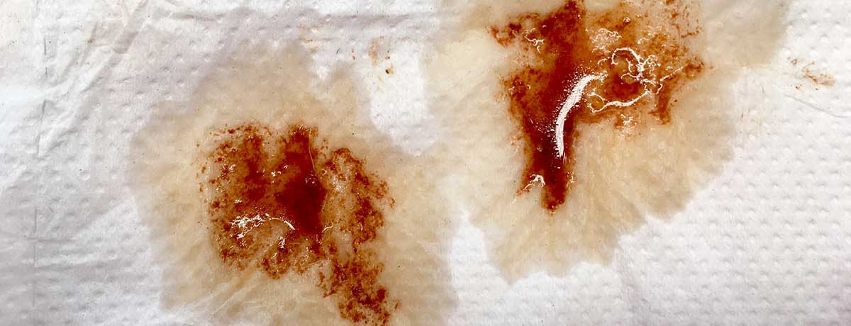 brown-vaginal-discharge30
